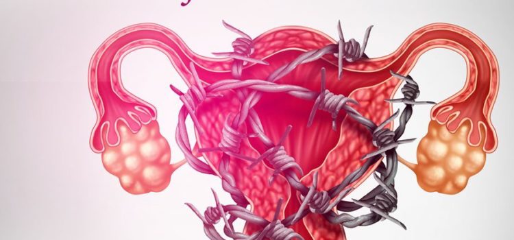 Endometriose, Saiba Identificar