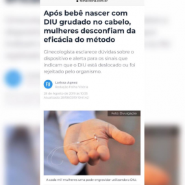 Entrevista para a Folha Vitória – Bebê nasce com diu grudado na cabeça, é verdade? Entrevista para a Folha Vitória – Bebê nasce com diu grudado na cabeça, é verdade?