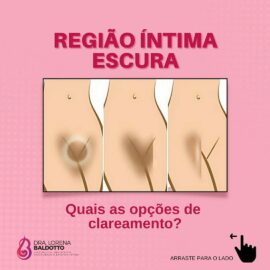 Região íntima escura. Quais as opções de clareamento?